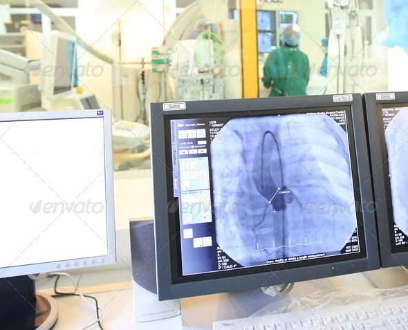 computer monitor during heart operation