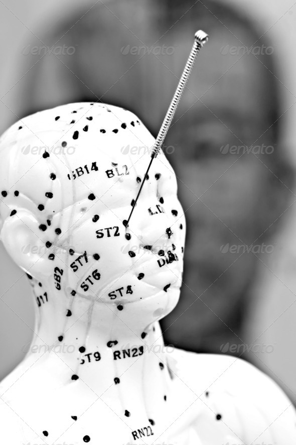 acupuncture needle on head model